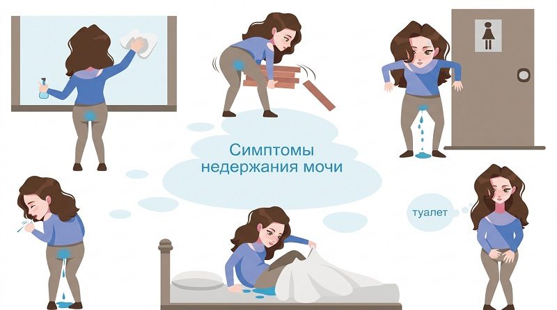 Симптомы недержания мочи