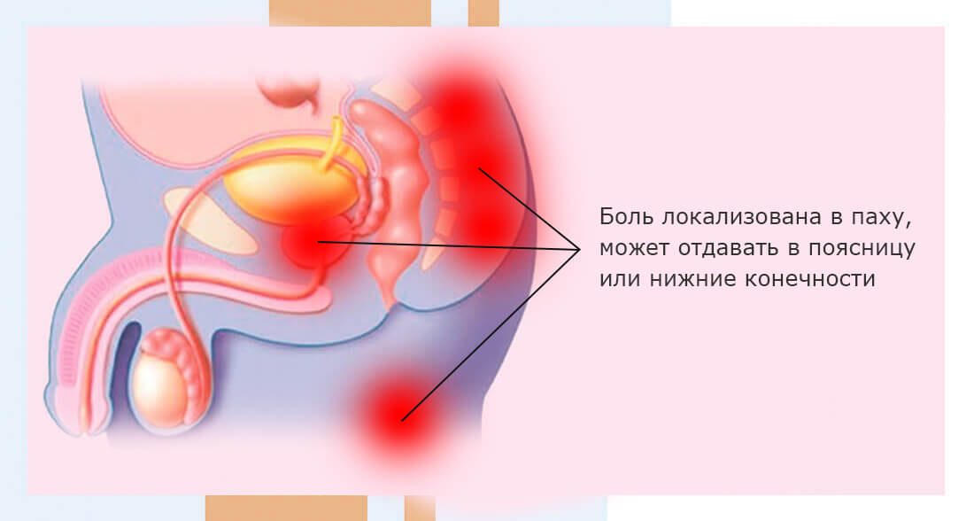 Симптомы простатита